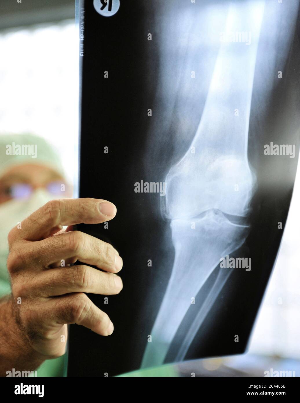 Doctor holds x-ray image of a knee joint Stock Photo - Alamy
