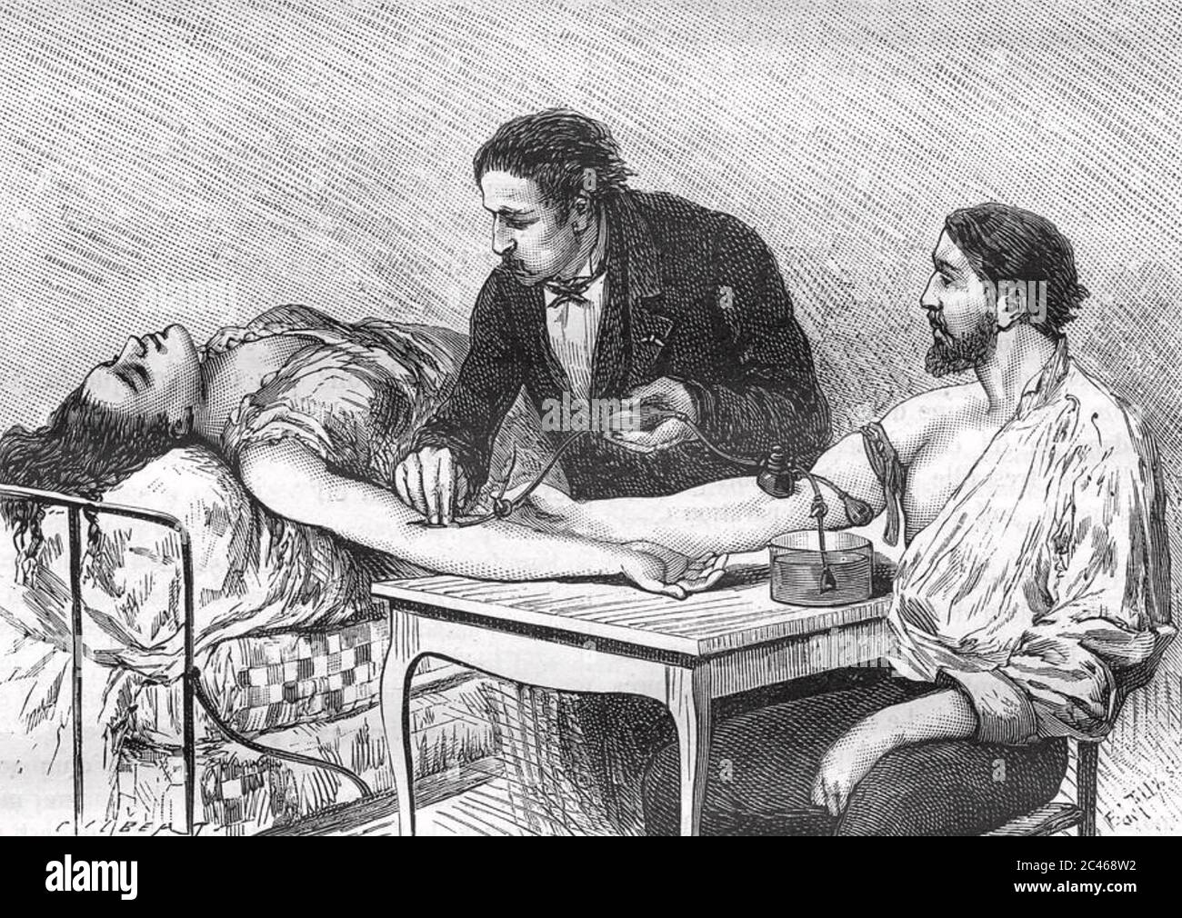 BLOOD TRANSFUSION directly person to person in the 1860s Stock Photo