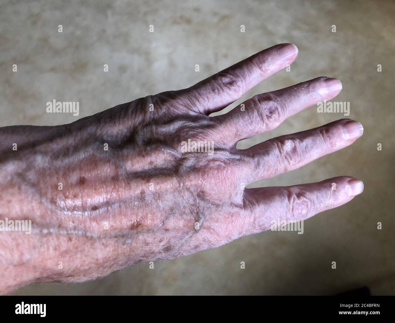 Age spots on the hand of a 72-year-old woman. Stock Photo