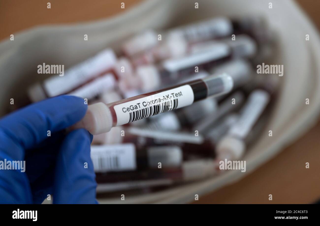 25 June 2020, Baden-Wuerttemberg, Tübingen: An employee of the Tübingen human genetics laboratory CeGaT holds a blood collection tube containing a blood sample for a corona antibody test. The laboratory has been offering antibody tests in the university city since the beginning of May. (to dpa: 'Helmholtz Centre researches the degree of infestation of Germans') Photo: Marijan Murat/dpa Stock Photo
