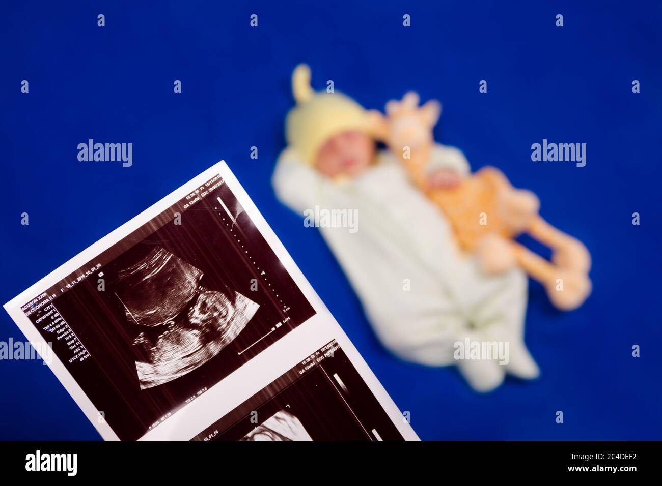 Charming newborn sleeping on a blue blanket. Ultrasound shot Stock Photo