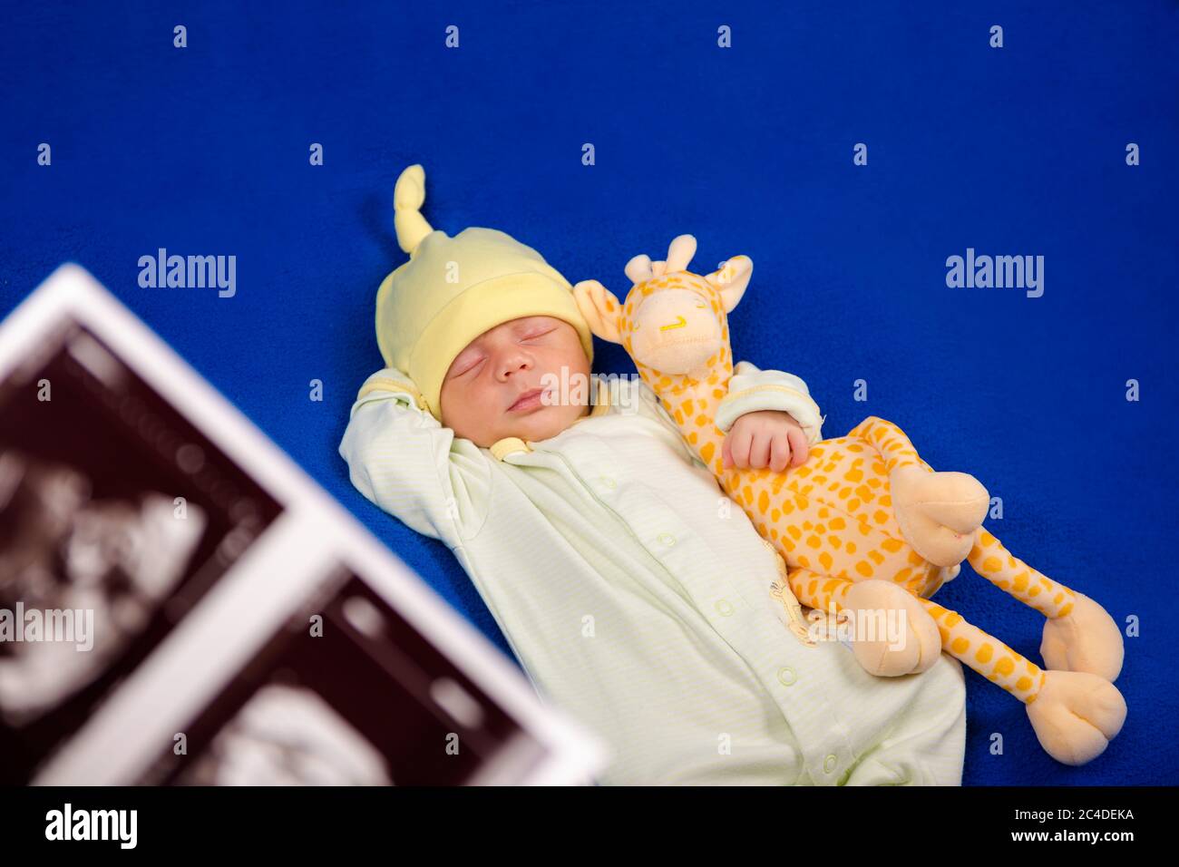 Sweet newborn sleeping on a blue blanket. Ultrasound shot Stock Photo