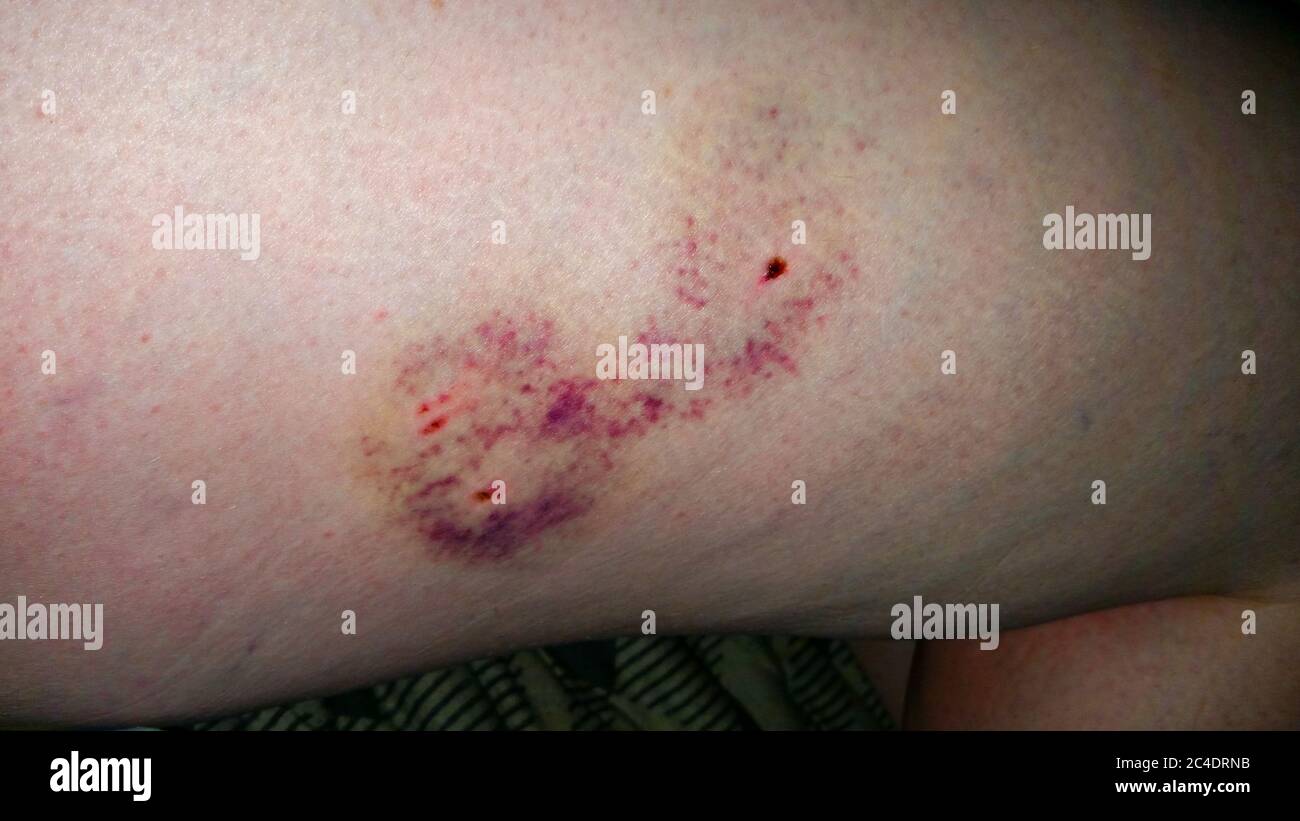 dog-bite-wound-infection-on-dog-at-erik-laird-blog