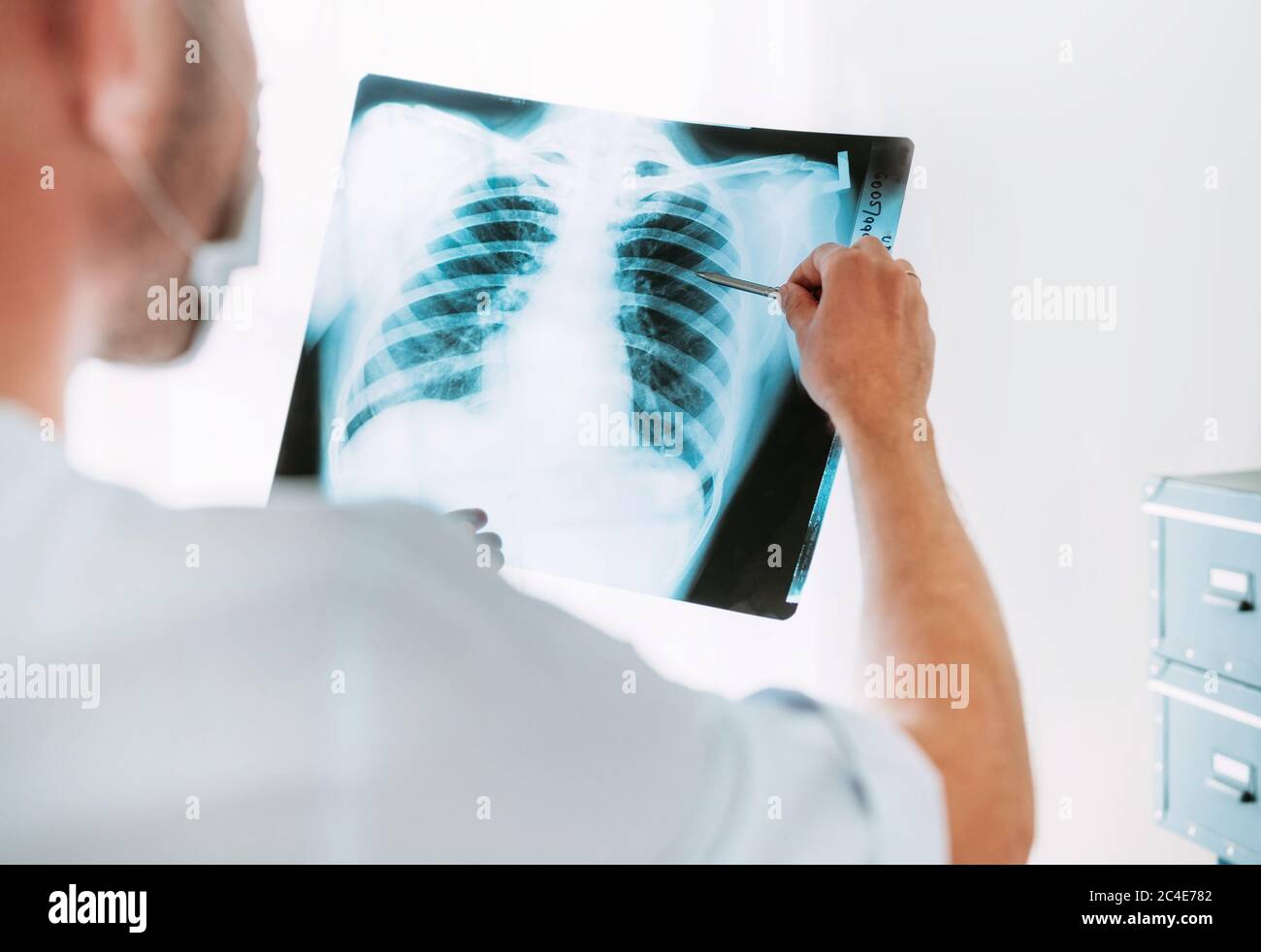 male doctor examining the patient chest x ray film lungs scan at radiology department in hospitalcovid 19 scan body xray test detection for covid wor 2C4E782