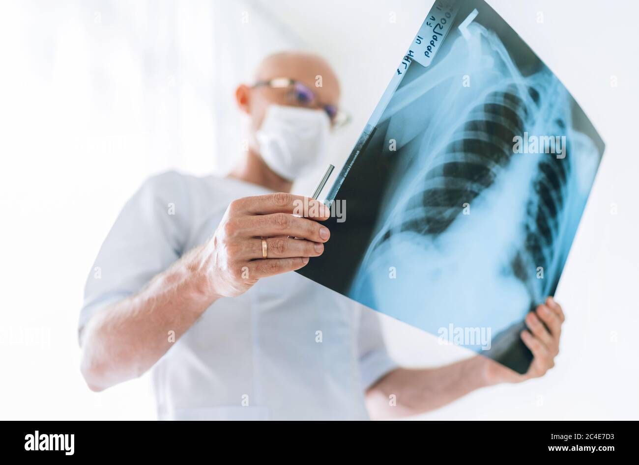 Mature Male doctor examining the patient chest x-ray film lungs scan at  radiology department in hospital. Scan close up. Covid-19 scan body xray  test Stock Photo - Alamy