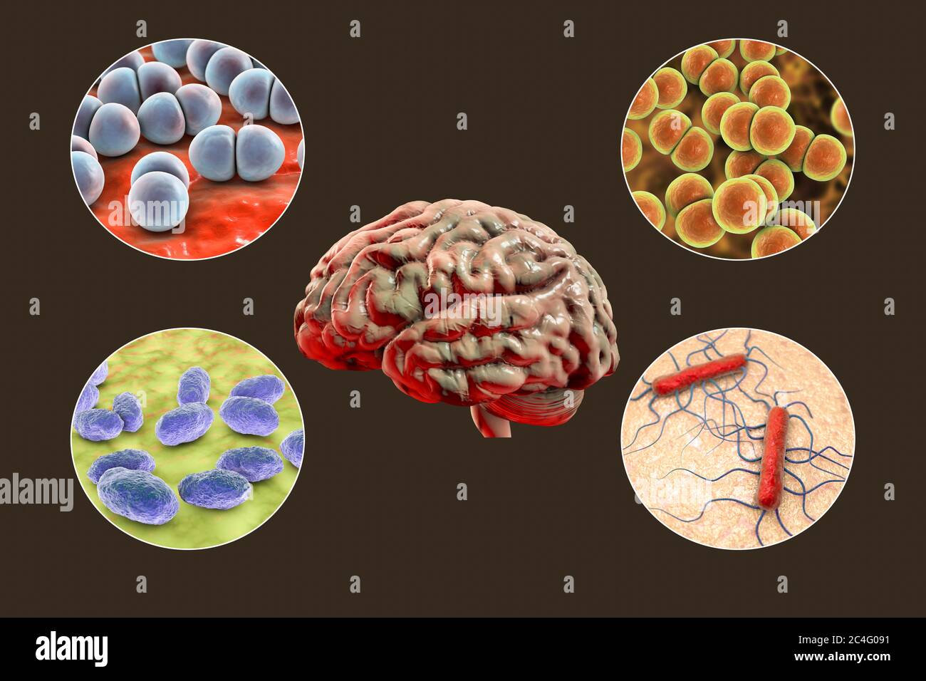 Causes Of Bacterial Meningitis Computer Illustration Neisseria Meningitidis Streptococcus Pneumoniae Haemophilus Influenzae And Listeria Monocytogenes Bacteria The Main Causative Agents Of Bacterial Meningitis Stock Photo Alamy Causes Of Bacterial Meningitis Computer Illustration Neisseria Meningitidis Streptococcus Pneumoniae Haemophilus Influenzae And Listeria Monocytogenes Bacteria The Main Causative Agents Of Bacterial Meningitis Stock Photo Alamy