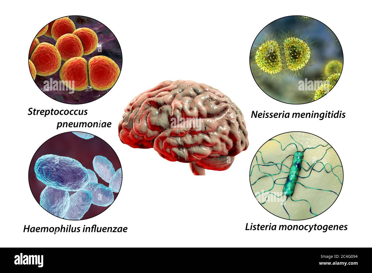 Causes of bacterial meningitis, computer illustration. Neisseria meningitidis, Streptococcus pneumoniae, Haemophilus influenzae and Listeria monocytogenes bacteria, the main causative agents of bacterial meningitis. Labelled image. Stock Photo