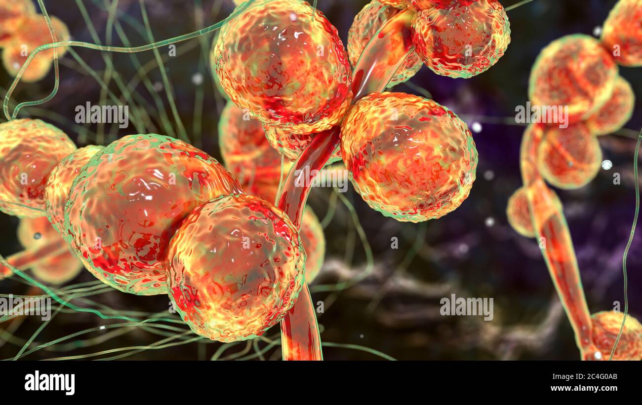 Computer illustration of the unicellular fungus (yeast) Candida ciferrii. C. ciferrii is a recently emerged fluconazole-resistant yeast that has been reported at an increasing rate as the cause of fungemia (bloodstream infection) and other systemic mycosis in immunocompromised patients. Stock Photo