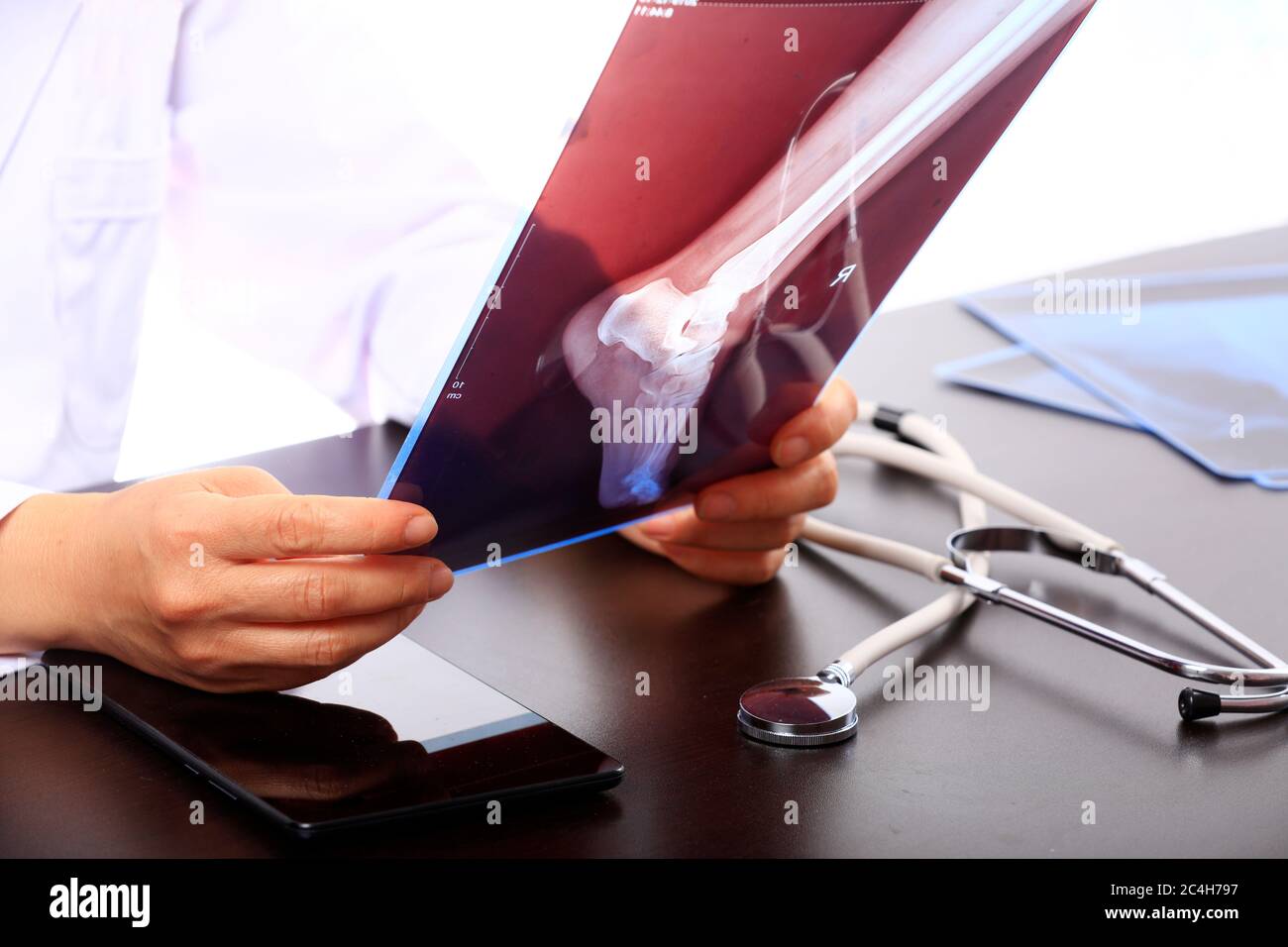 Woman Doctor Looking at X-Ray Radiography in patient's Room, doctor radiology looking x-ray film of patient at hospital. Stock Photo