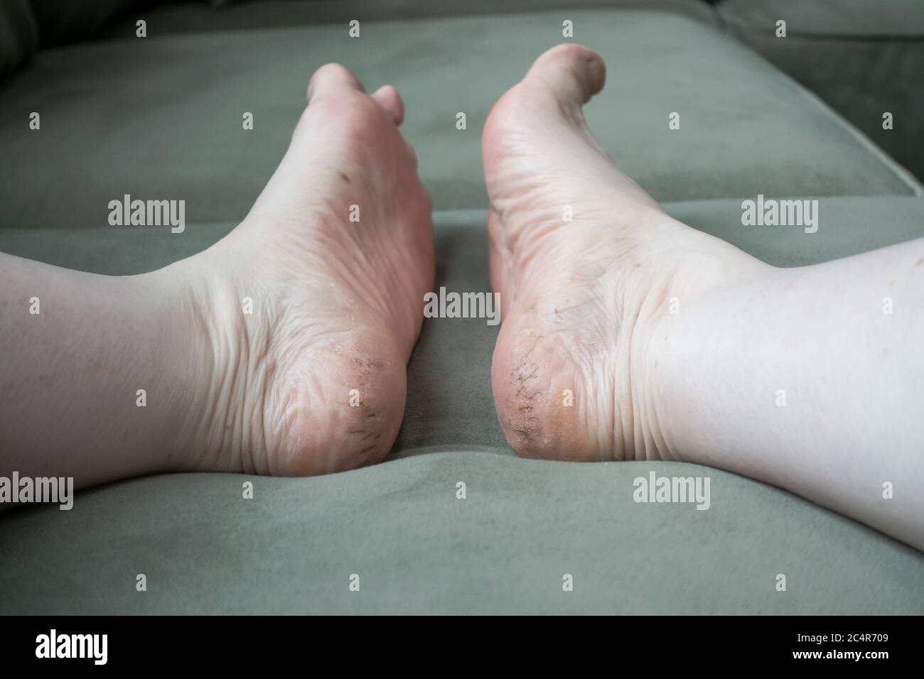 Rough Feet Images, Stock Photos & Vectors - Shutterstock