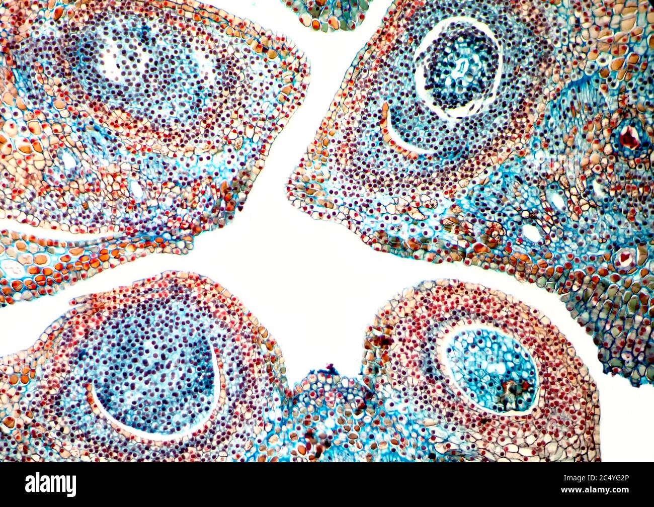 SCIENCE, MICROSCOPY, BIOLOGY, PLANT, cone of Horizontal 3 mm