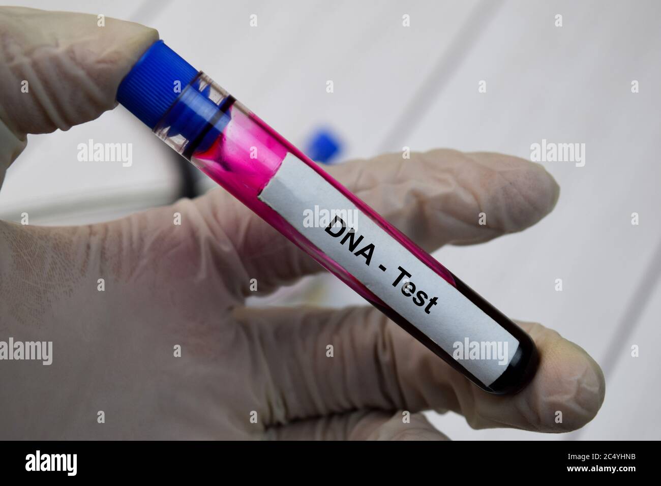 DNA Test text with blood sample. Top view isolated on black background ...
