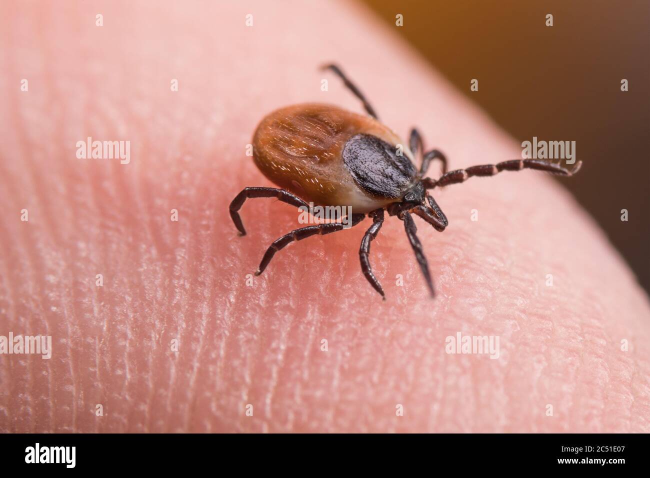 Female deer tick on skin of human finger. Ixodes ricinus or scapularis. Close-up of parasitic mite in dynamic motion on fingertip Stock Photo
