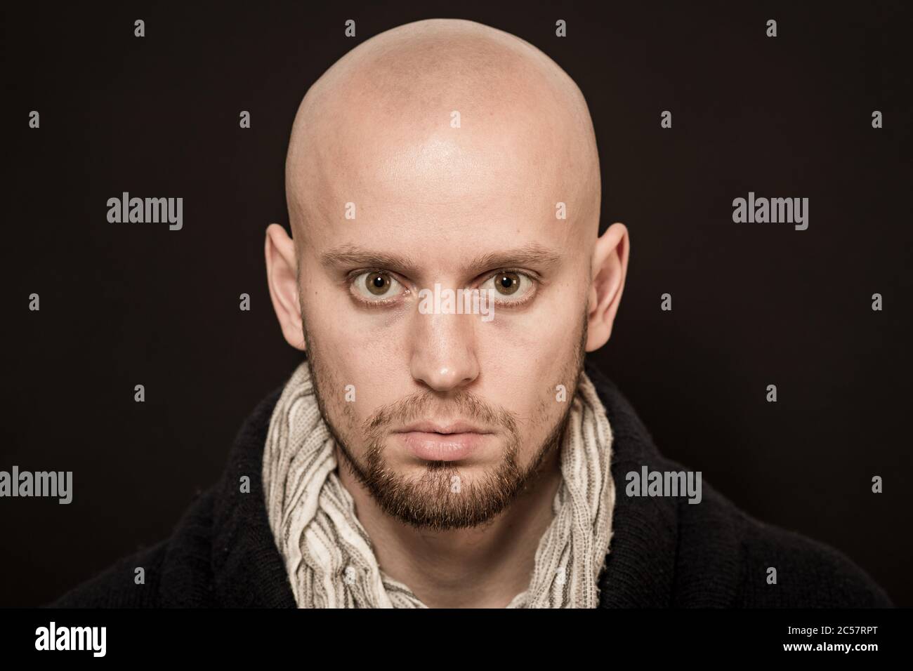 skinhead baldness shaved head man angry racist Stock Photo