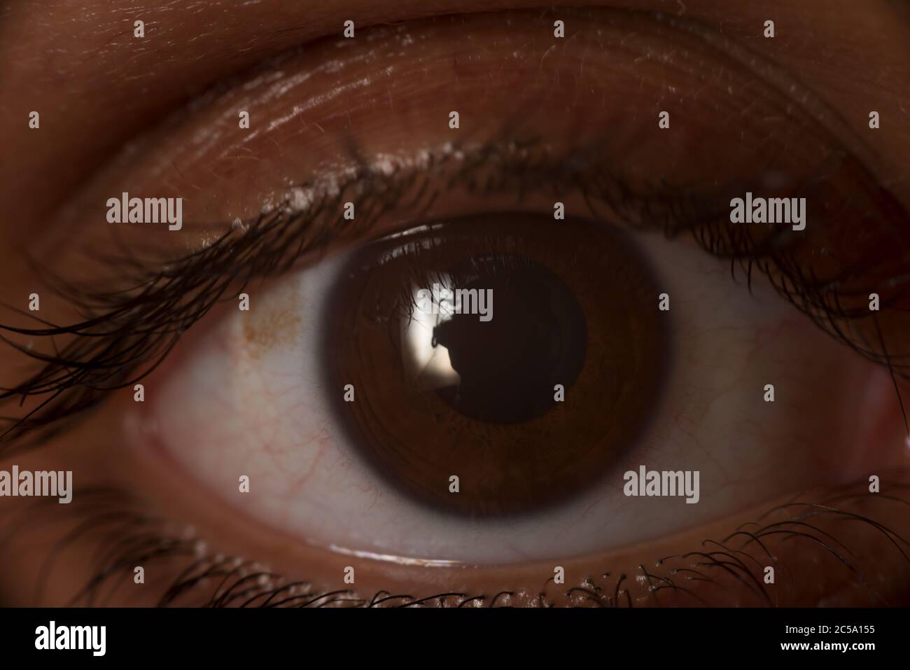 Dark brown human eye, cornea and outer layer of the eyeball, with ciliary muscle; ring of smooth muscle Stock Photo