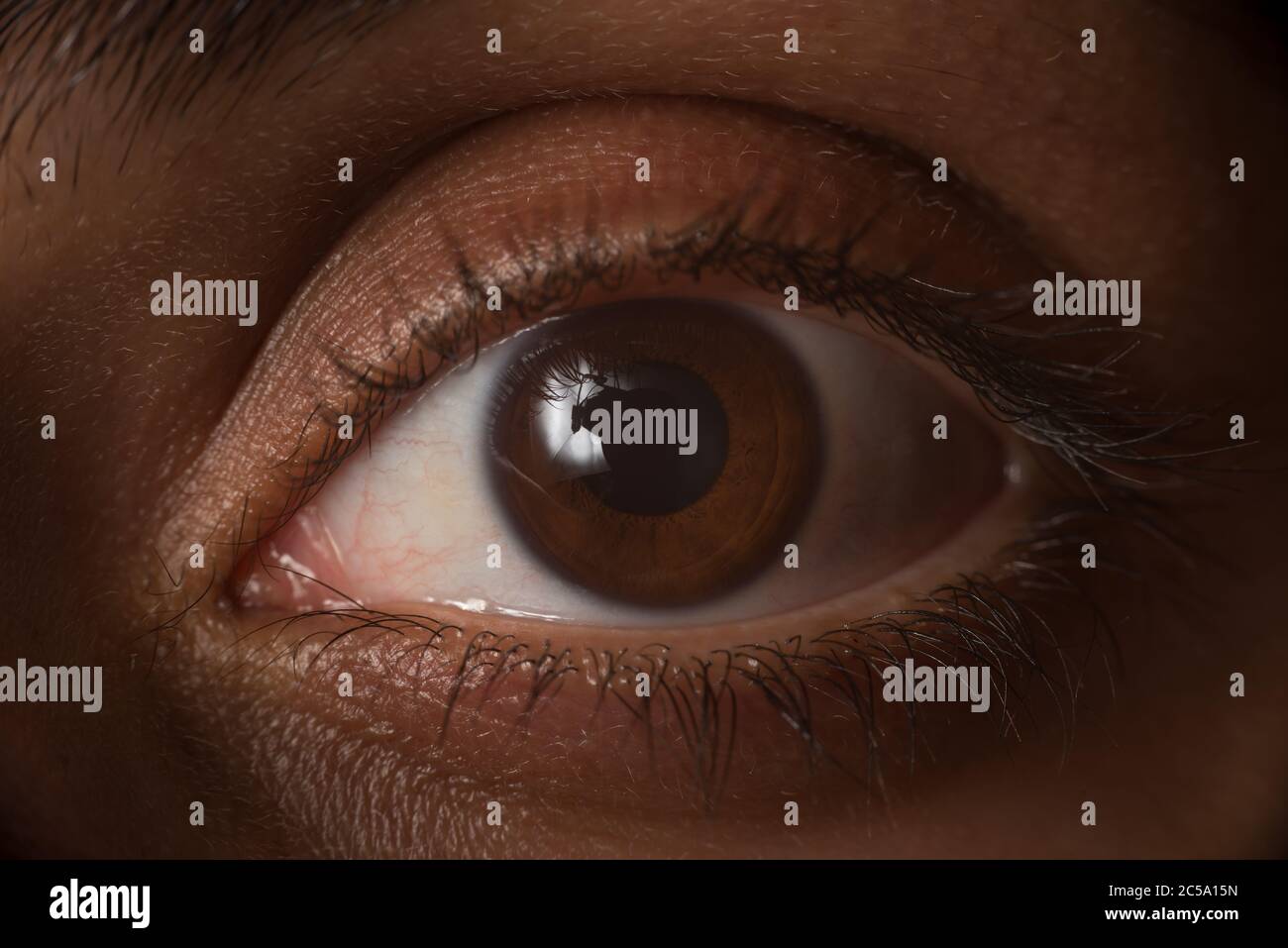 Dark brown human eye, cornea and outer layer of the eyeball, with ciliary muscle; ring of smooth muscle Stock Photo