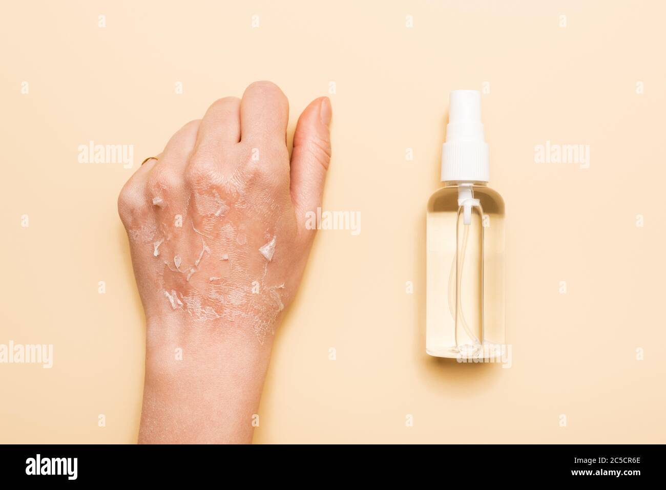 Download Page 2 Dehydrated Skin High Resolution Stock Photography And Images Alamy PSD Mockup Templates