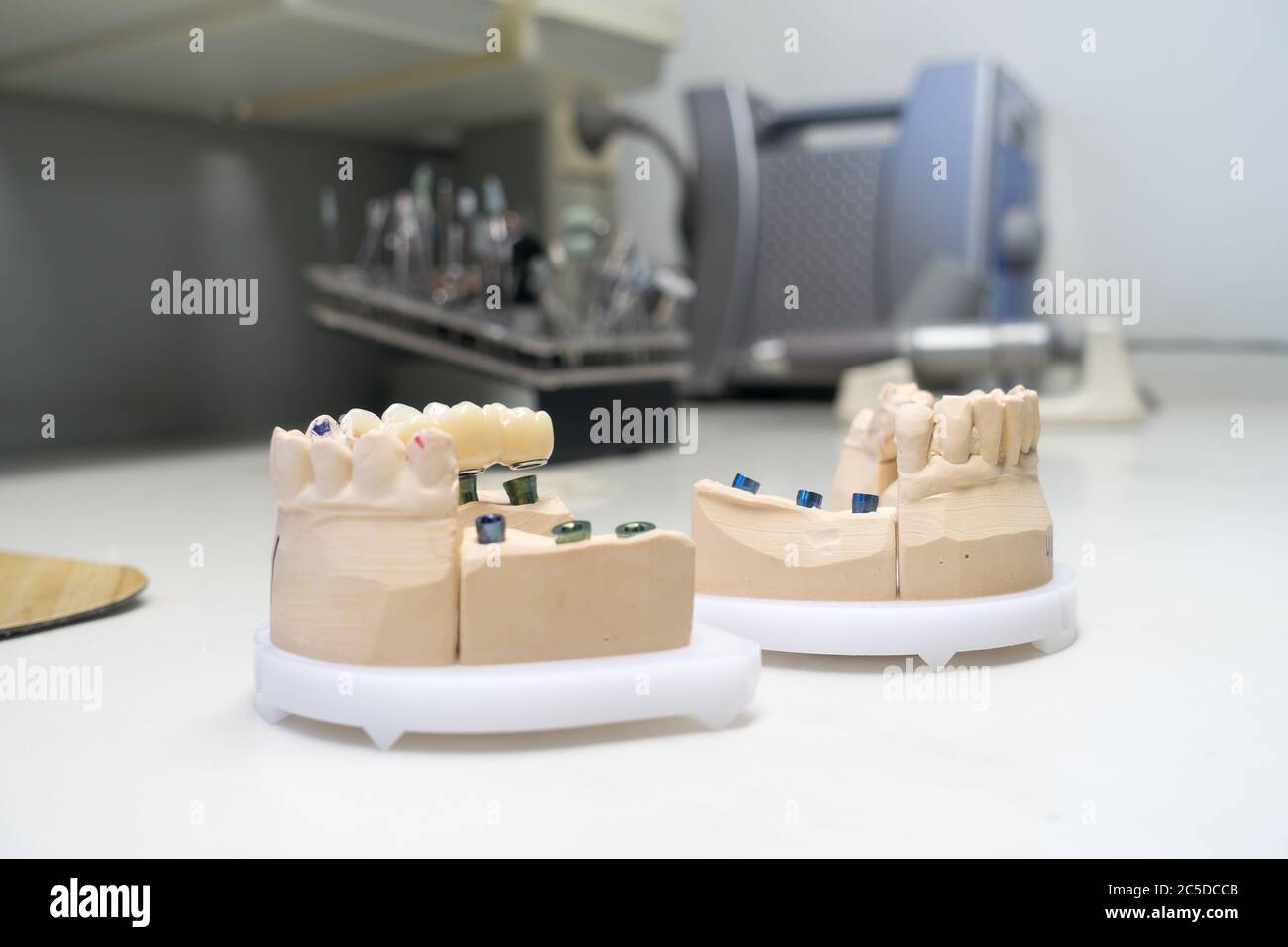 zirconia dental crowns on dental models in the dental laboratory Stock