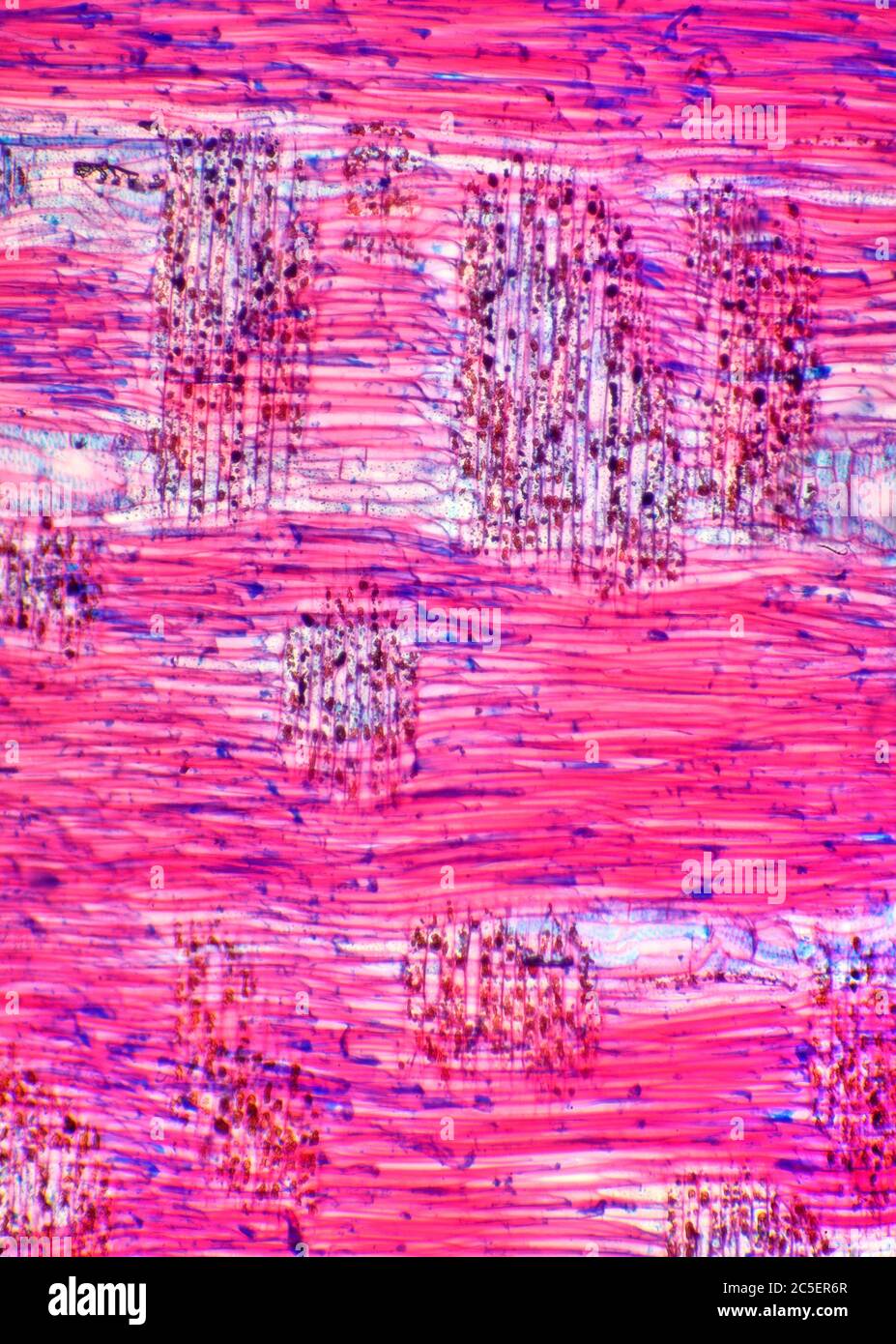 English Elm, root section, Ulmus procera, brightfield photomicrograph Stock Photo