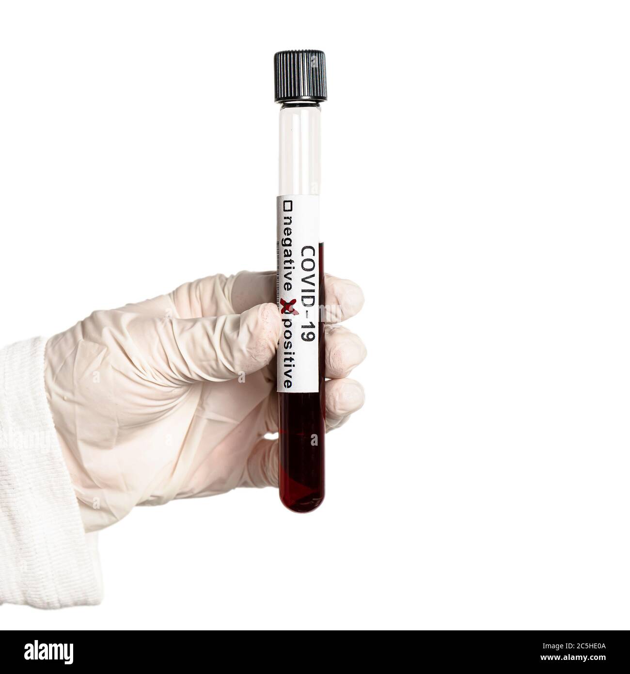 Hand holds a test tube containing a blood sample, test tube  for Covid-19 (coronavirus) analyzing. Laboratory testing patient’s sample Stock Photo