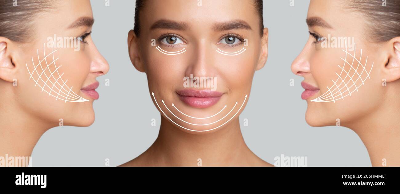 Beautiful woman with arrows on face for lifting skin Stock Photo
