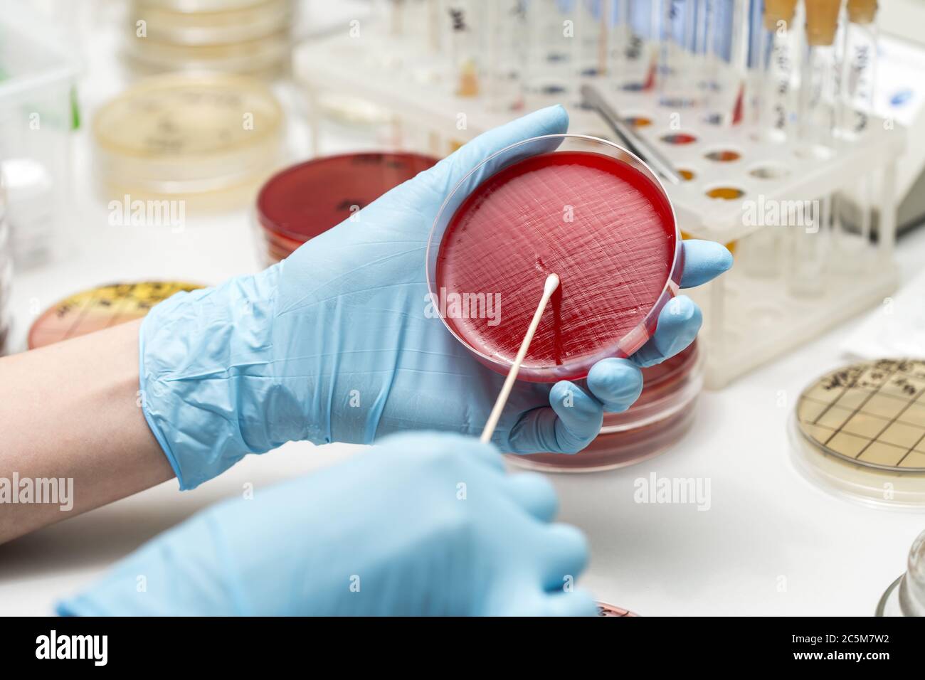 lab technician hand planting a petri dish Stock Photo Alamy