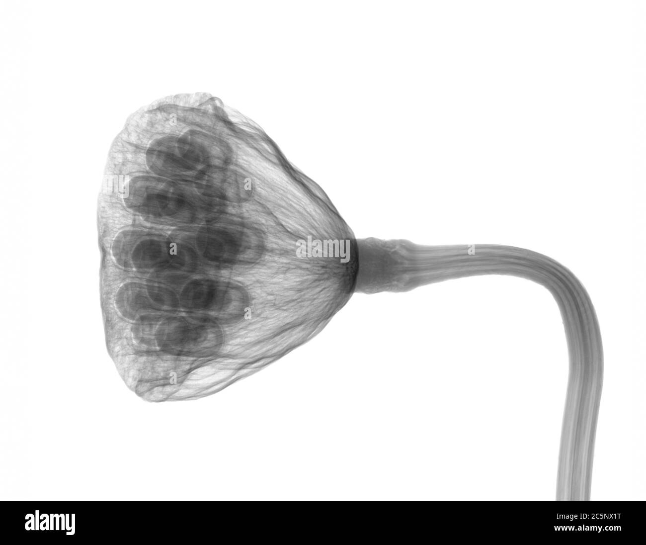 Lotus seed head, X-ray. Stock Photo