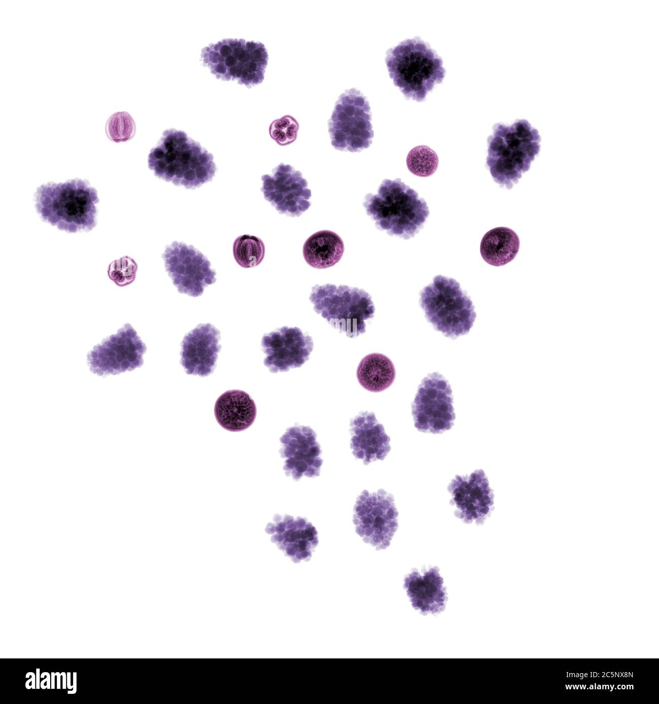 Blackberries (Rubus fruticosus) and acai palm fruit (Euterpe oleracea), coloured X-ray. Stock Photo