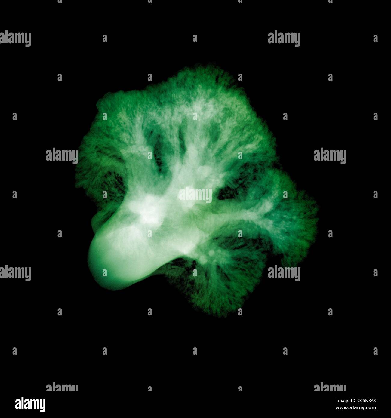 Broccoli (Brassica oleracea), coloured X-ray. Stock Photo