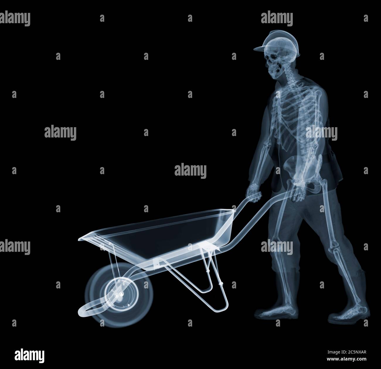 Workman with wheelbarrow, coloured X-ray. Stock Photo