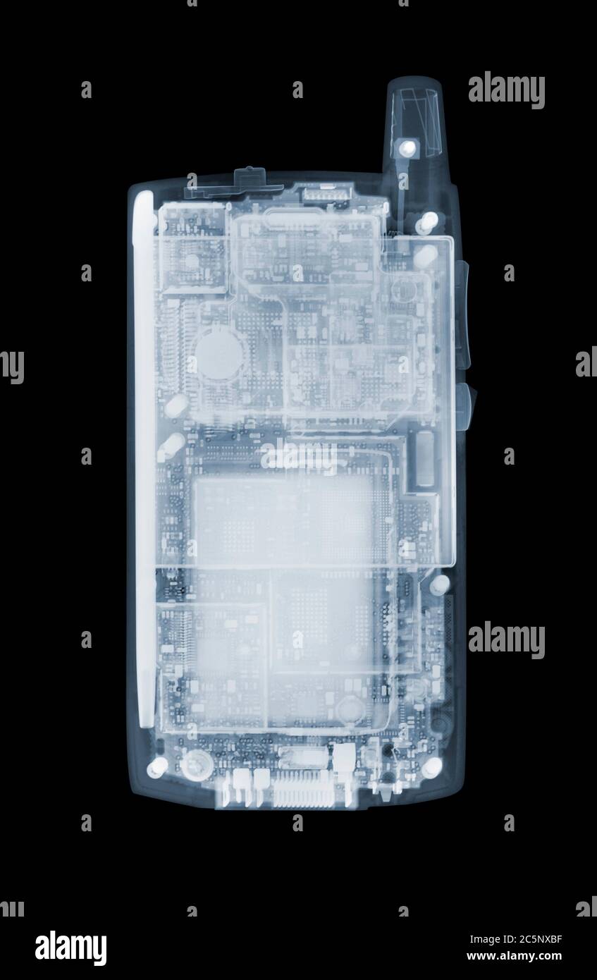 PDA, coloured X-ray. Stock Photo