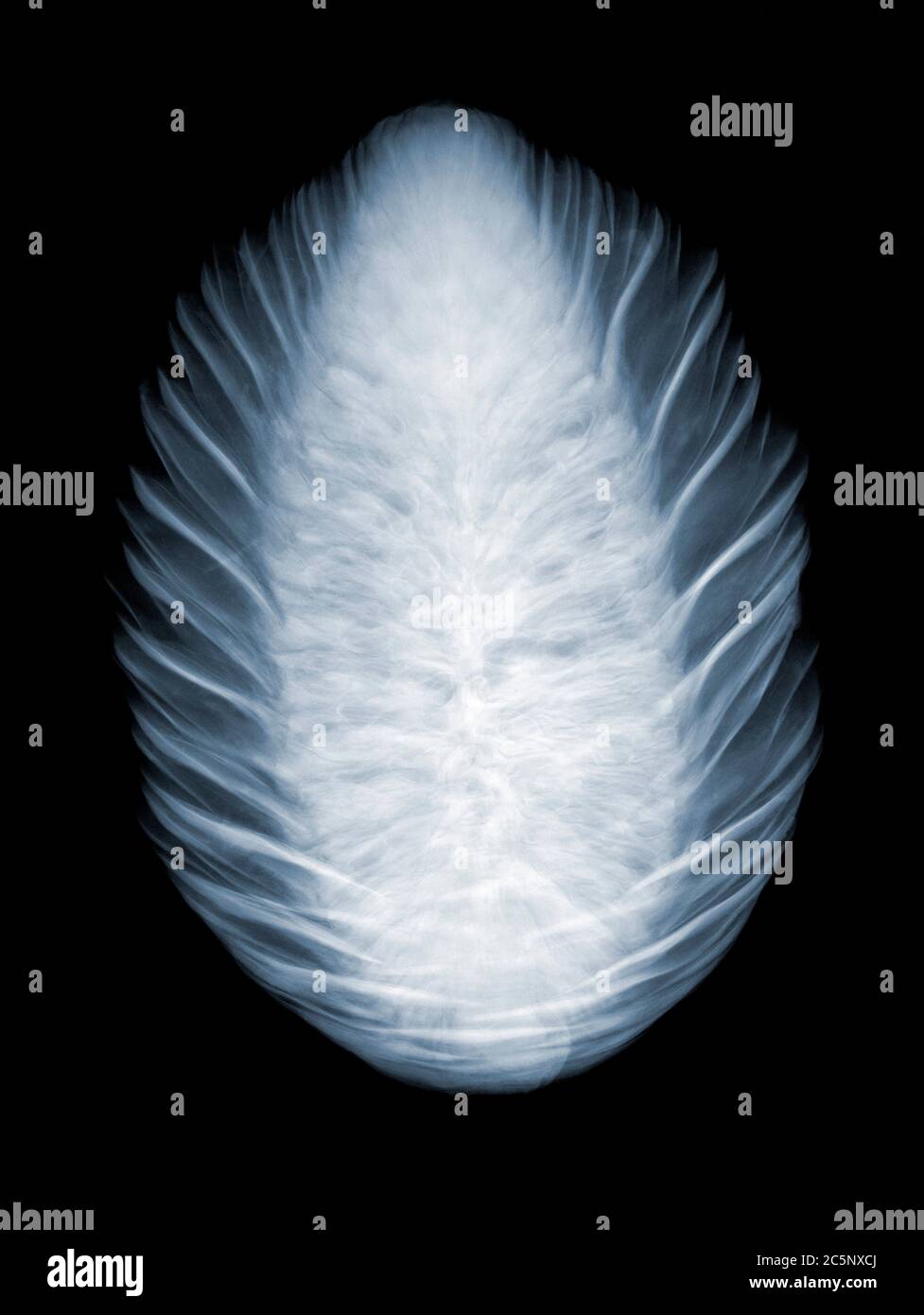 Norway spruce (Picea abies) cone, coloured X-ray. Stock Photo