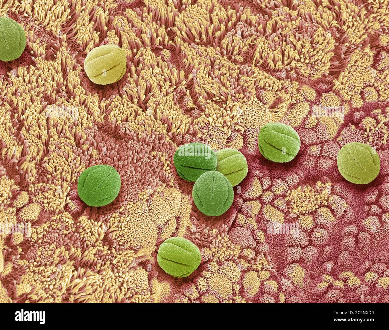Composite image of nasal epithelium and pollen. Coloured Scanning Electron Micrograph (SEM) of the surface of nasal epithelium with inhaled in pollen. Stock Photo
