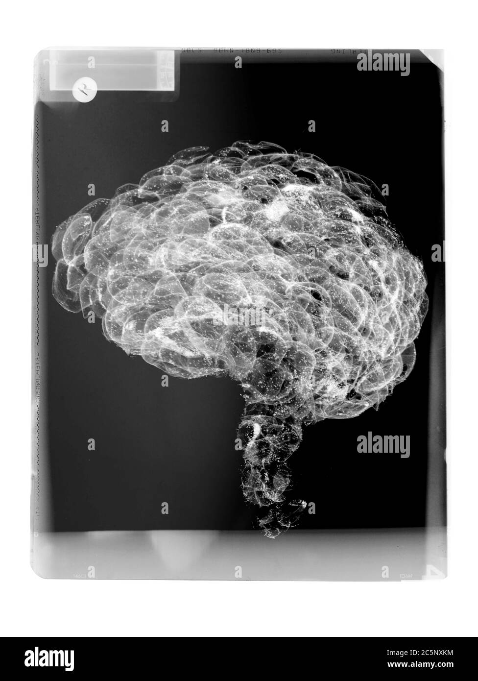 Mammal brain on film, X-ray Stock Photo