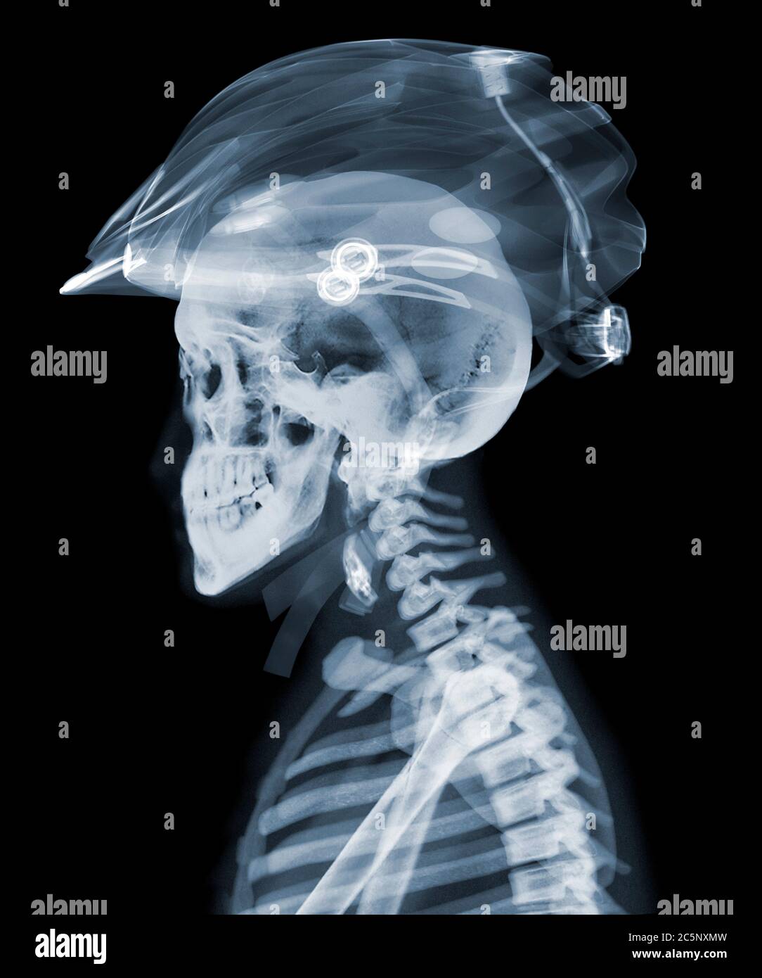 Sports helmet anatomy hires stock photography and images Alamy