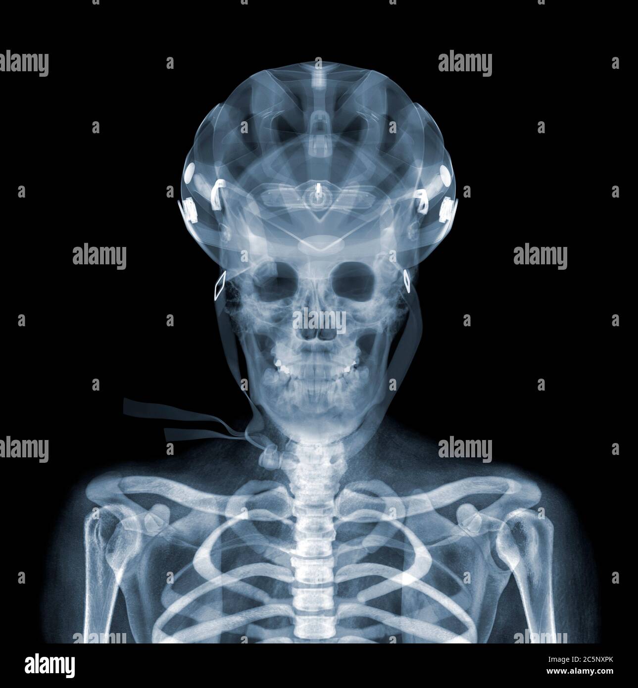 Bicycle helmet and rider, X-ray Stock Photo - Alamy