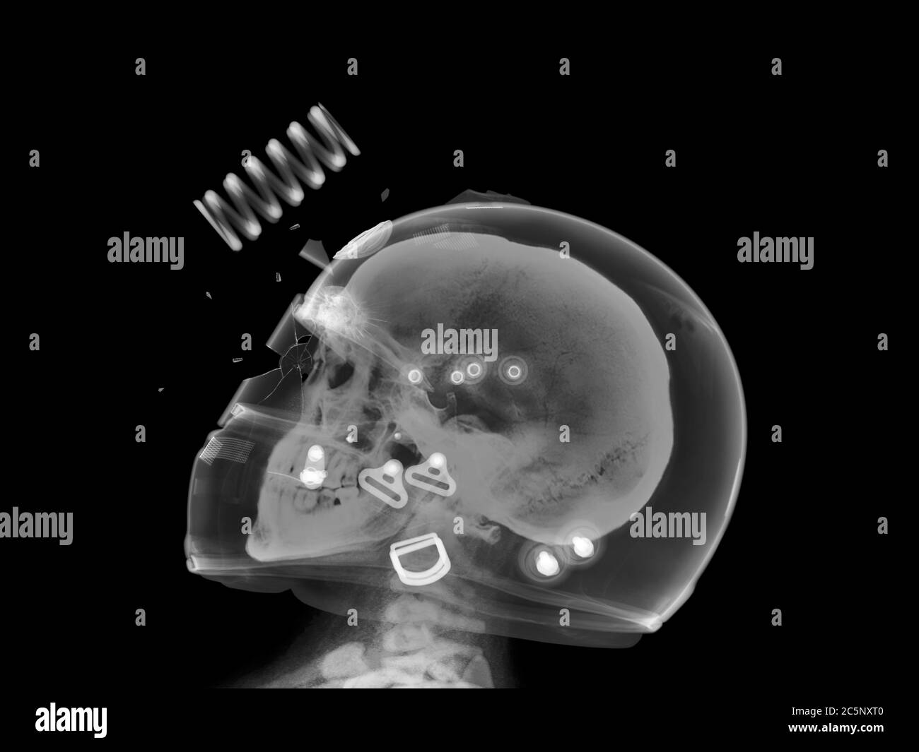 Skull and damaged helmet and visor, X-ray. Stock Photo