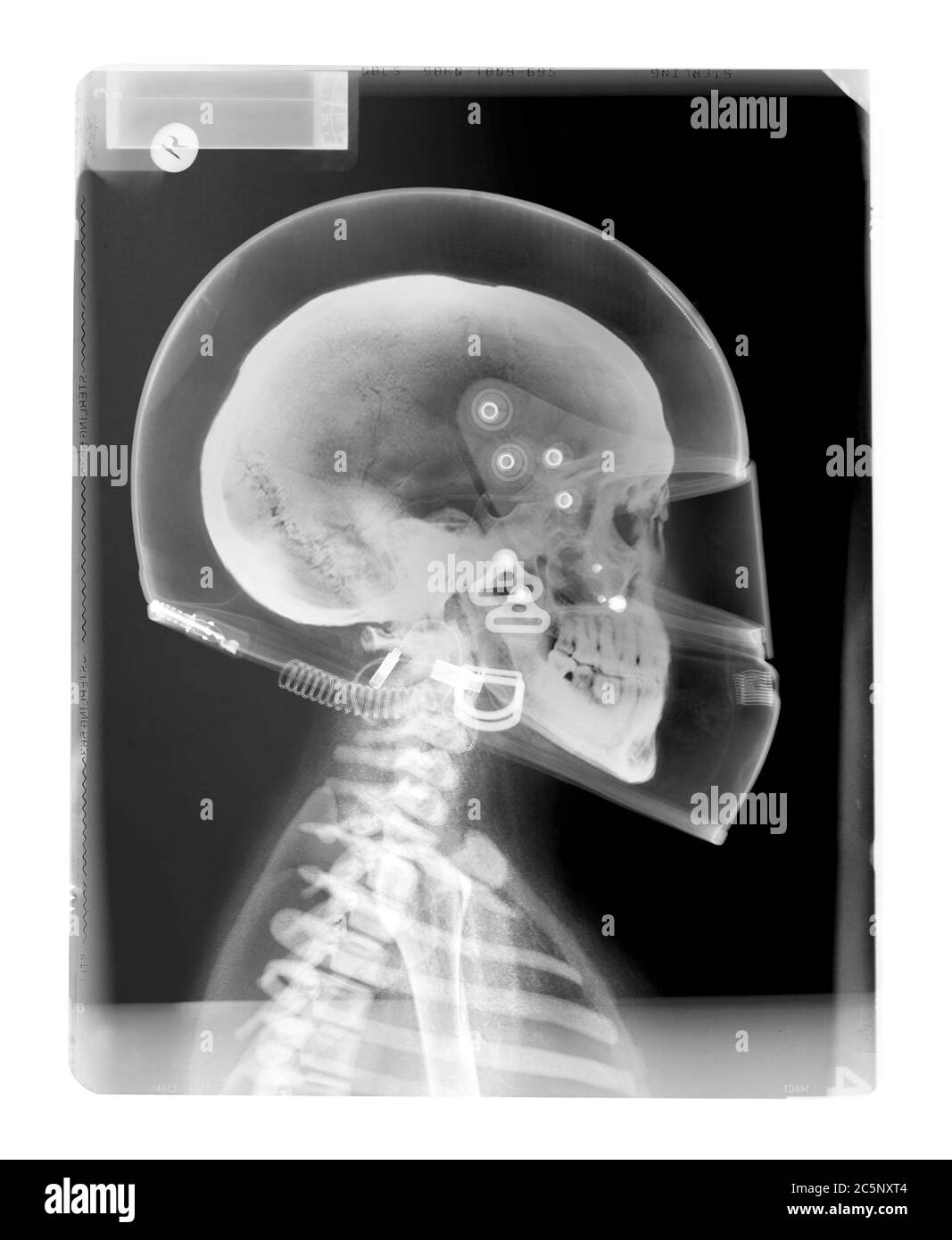 Skull and helmet, X-ray. Stock Photo