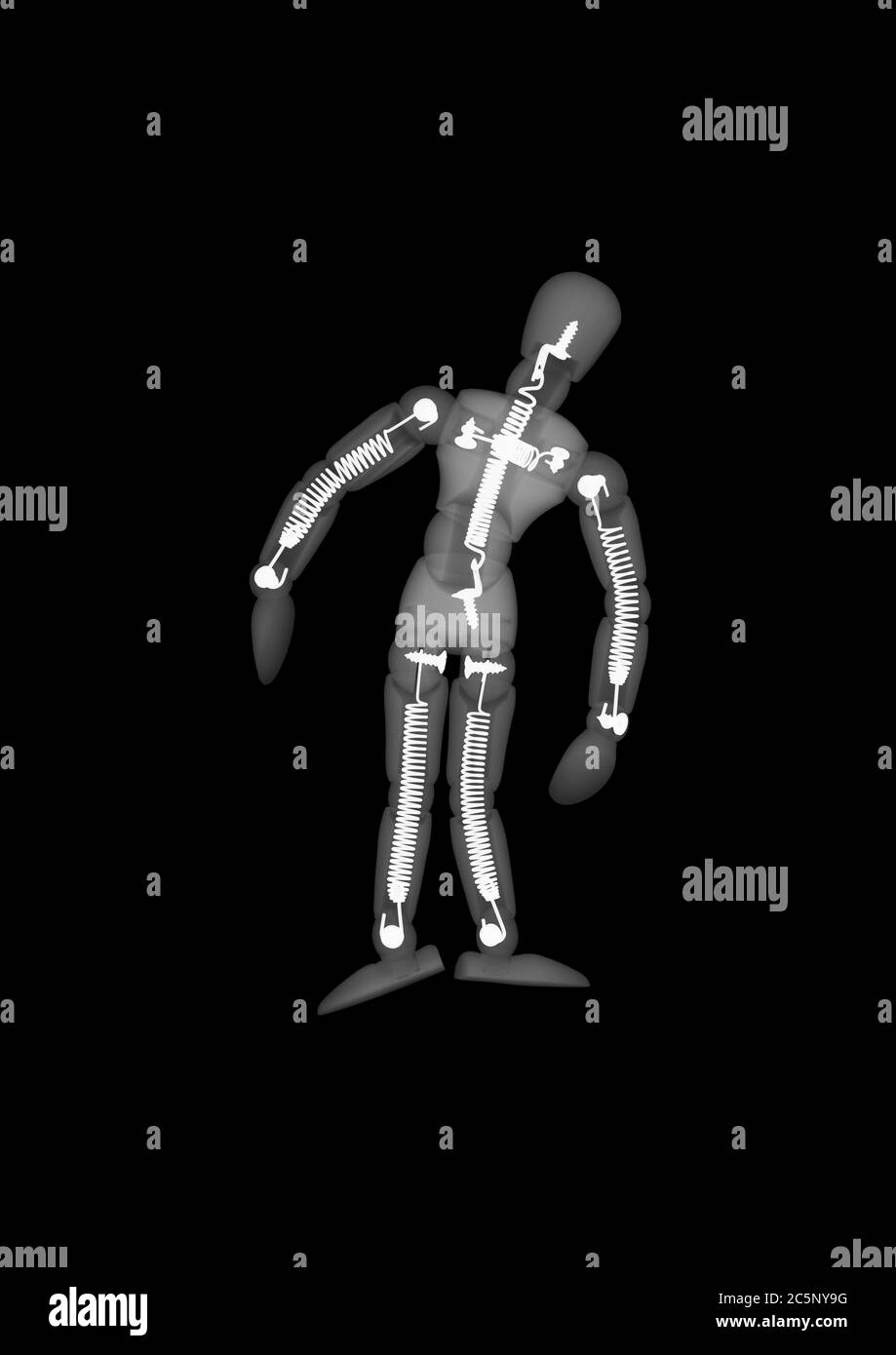 Wooden figure, X-ray. Stock Photo