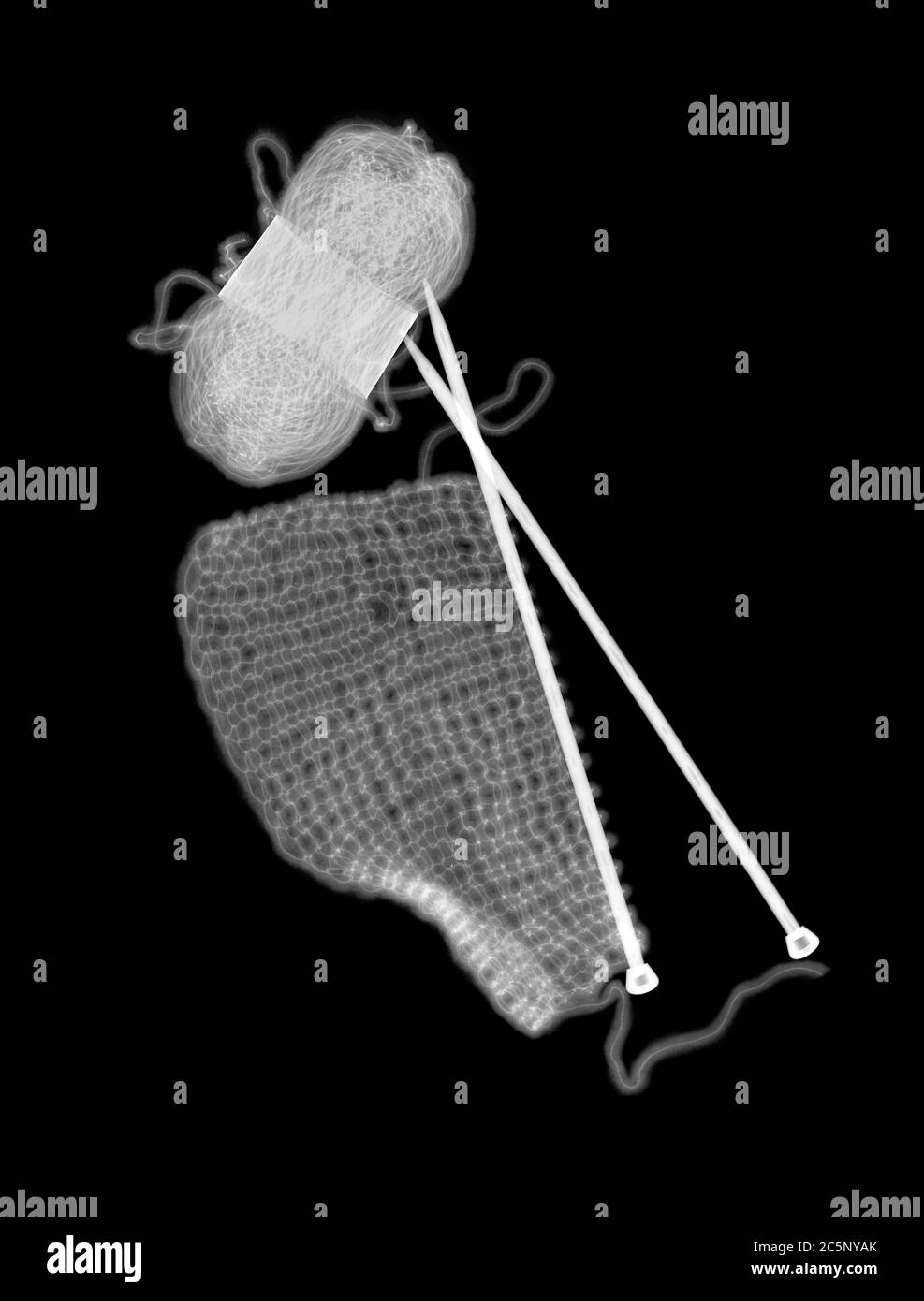 Knitting, X-ray. Stock Photo