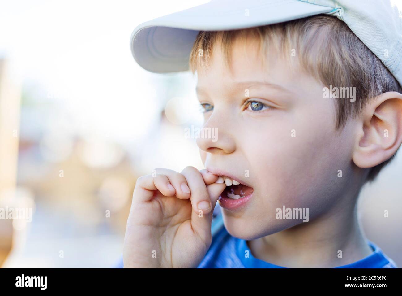 Closeup of boy shaking his wobbly milk tooth with his fingers. Upper