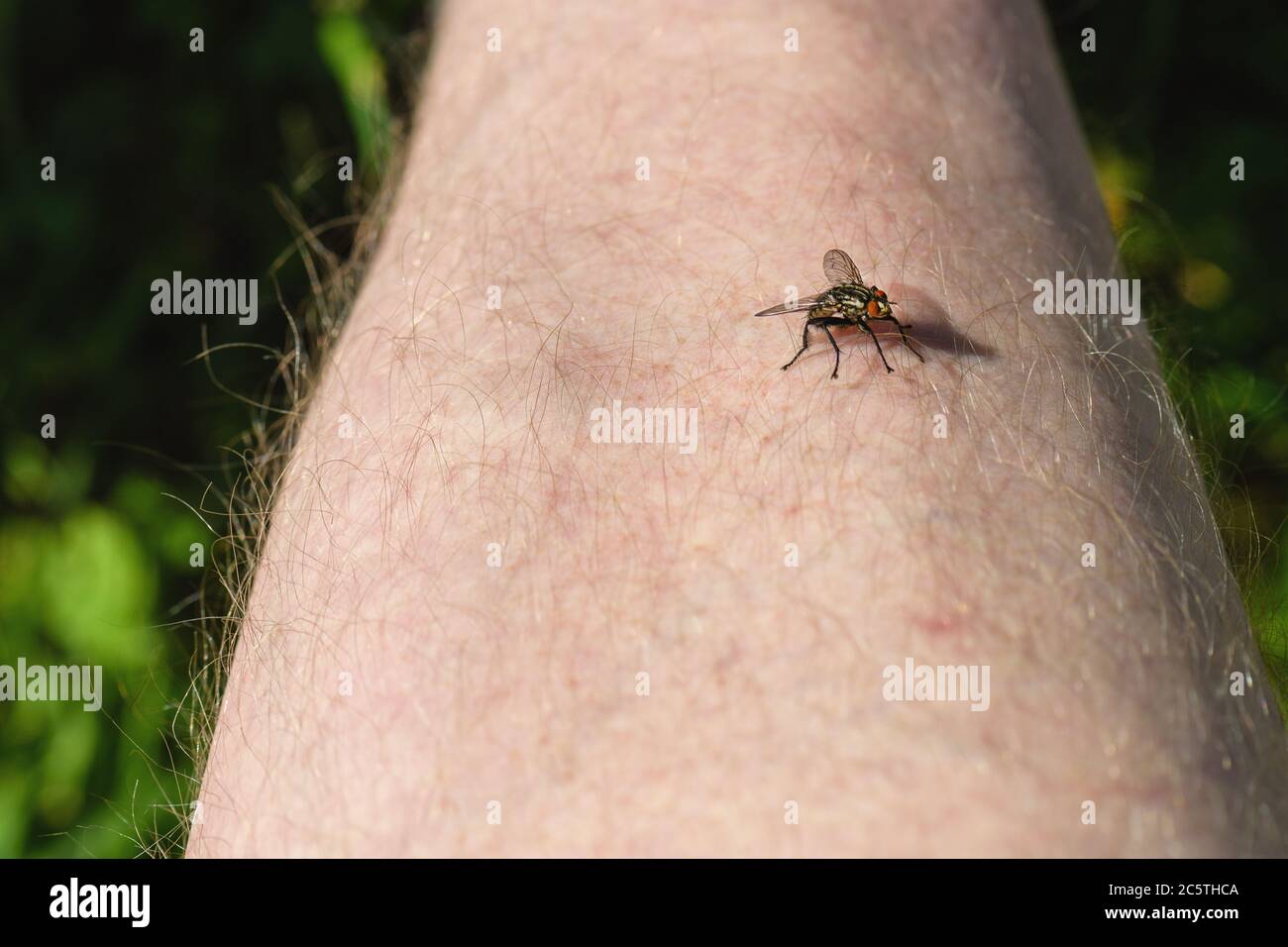 Black fly bites hires stock photography and images Alamy