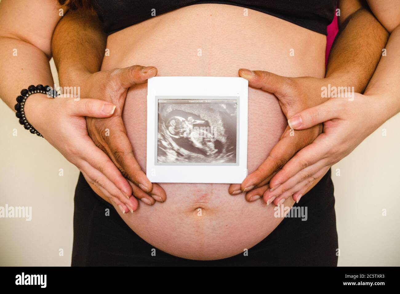 Ultrasound image of mother's belly held by mum and dad Stock Photo