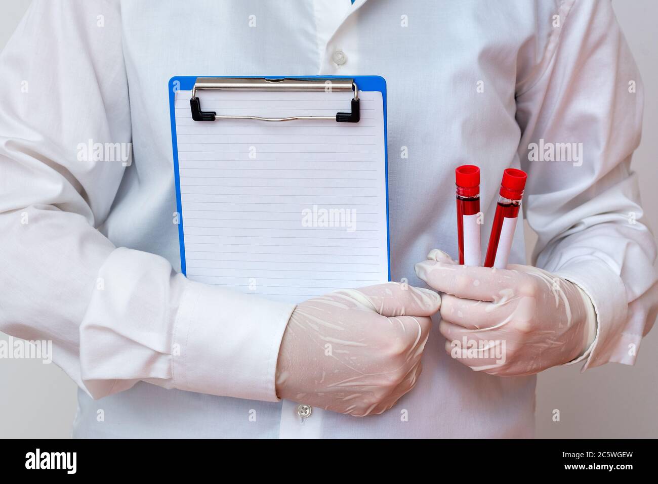 Laboratory Blood Test Sample Shown For Medical Diagnostic Analysis ...