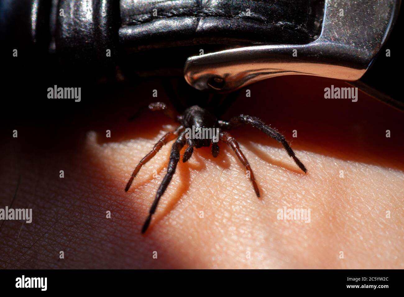 a small poisonous spider on the arm of a man bites the skin injects ...