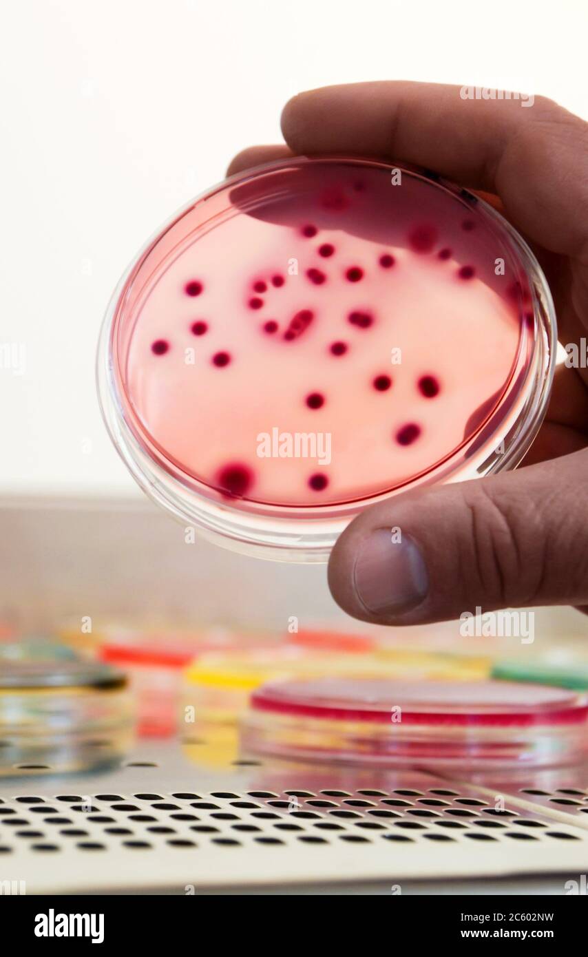 Escherichia coli bacteria petri dish hi-res stock photography and ...