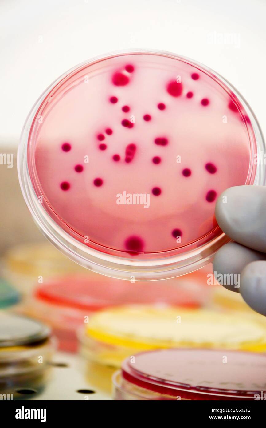 Bacterial colonies culture on Differential and Selective media
