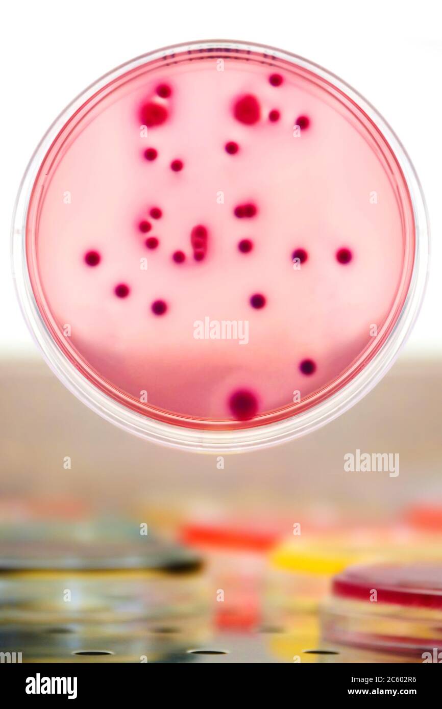 Bacterial colonies culture on Differential and Selective media
