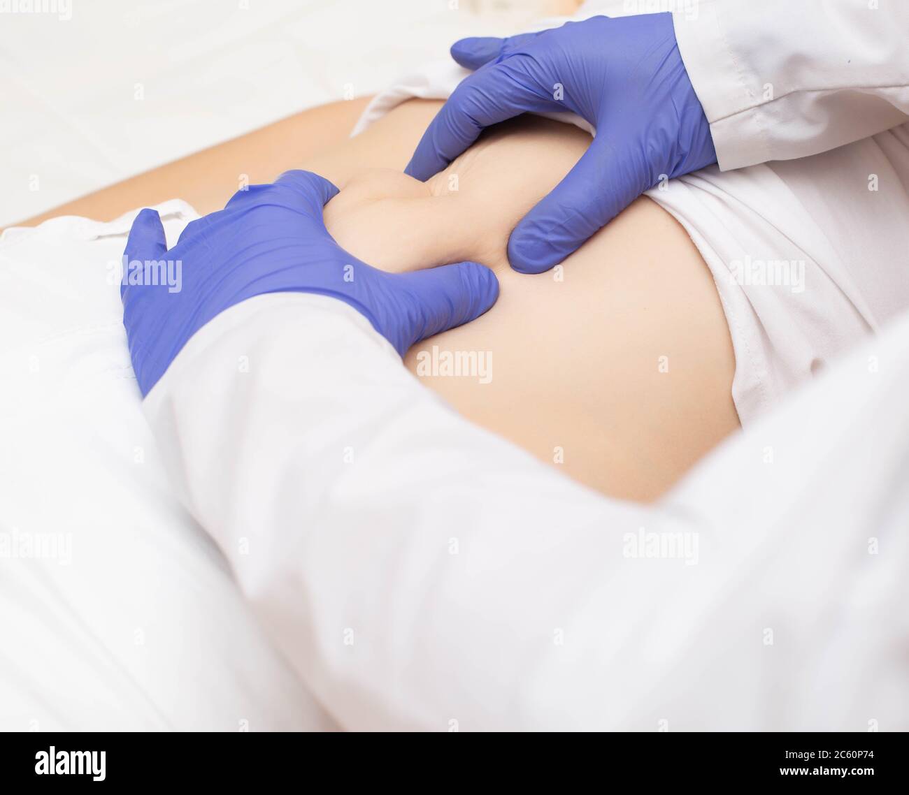 Doctor surgeon examines the stomach of a girl patient for the presence of umbilical hernia. Abdominal wall disease concept with umbilical hernia Stock Photo