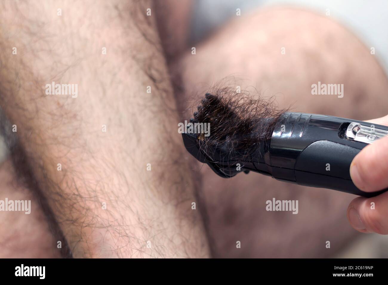 Epilation of excessive hair on the male leg. An electric razor filled with cut hair. Stock Photo